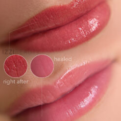 Lip pigmentatie voor en na