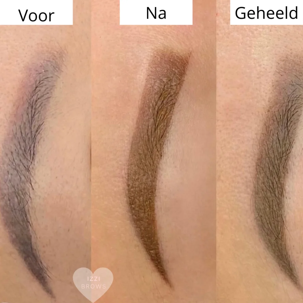 PMU Kleurcorrectie Behandeling