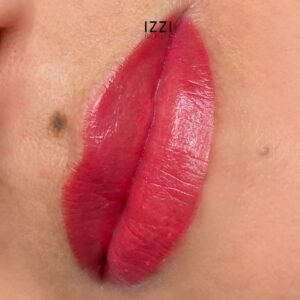 Lip Pigmentatie voor en na