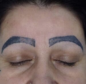 Wat als permanente make up is mislukt?