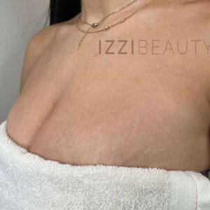 Inkless Stretch Mark opleiding IZZI