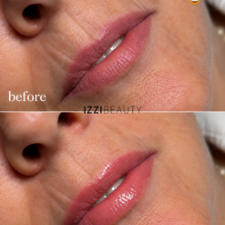 Lip Booster Treatment before & After - Online Training including Certificate